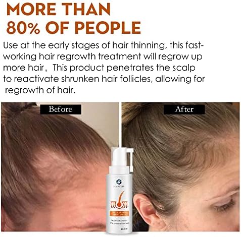 2PCs Produtos naturais de perda de cabelo nutrem o couro cabeludo e mantêm raízes Cabelo de crescimento Spray Spray Fast Cresh Hair