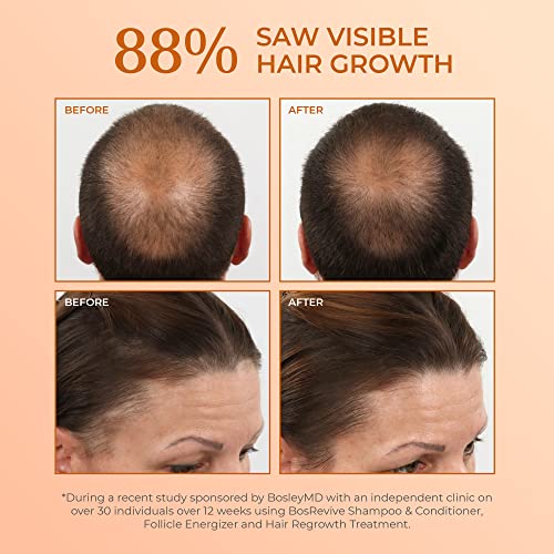 Bosleymd Hair Growth Set para homens e mulheres, inclui energizador folículo, bloqueador de DHT, para regenharia de