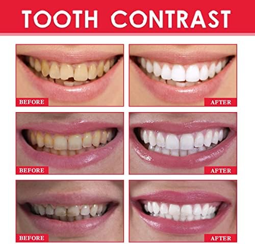 7:002 am2 dentes de dentes elétricos Brancho de dente iluminando as manchas de dente