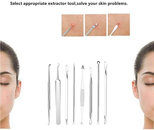 Yuelife Professional ComedOne Extrator Ferramentas, removedor de cravo de aço inoxidável Easy 3 etapa Treatment de acne Pimple Popper