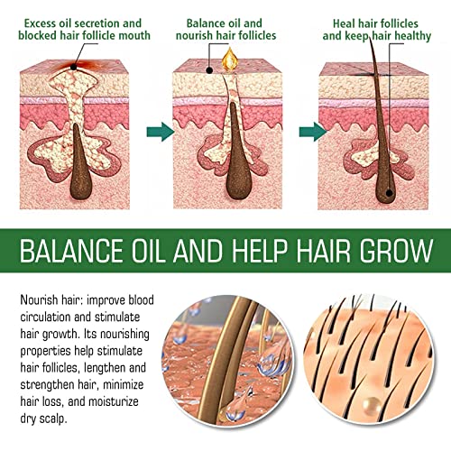 O óleo de crescimento capilar para o crescimento do crescimento do cabelo nutre o couro cabeludo estimula o crescimento