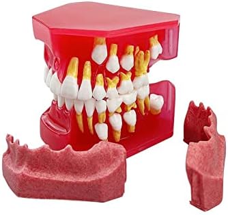Modelo de dente decíduos de crianças KH66ZKY, modelo educacional de dentes, modelo alternativo de dentes primários e