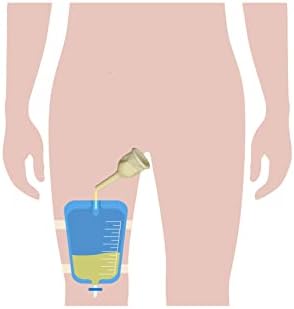 Kit completo urinário 5 dias 5 cateteres de preservativo de borracha externa auto-ereta média 25 mm 1 polegada + saco de pernas