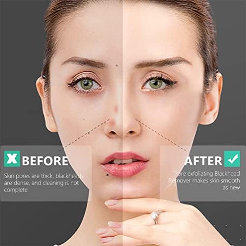 ALREMO XINGHUANG - 2PCS Face Blackheads Limpando escovas manuais de limpeza de face Muscha de limpeza profunda Limpadores