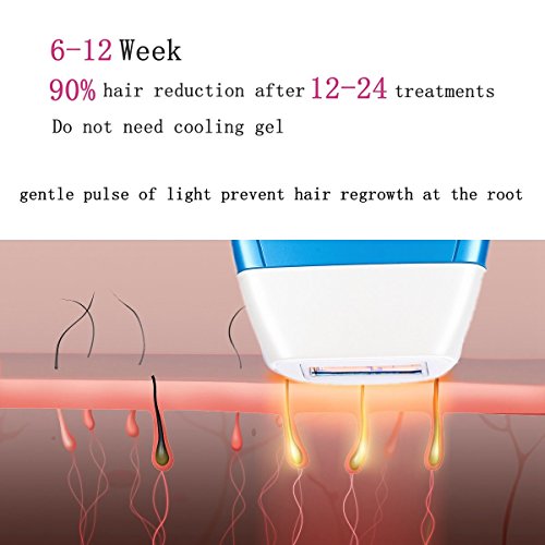 Sistema de remoção de cabelo - dispositivo permanente de remoção de cabelo indolor, 400000 Flashes Epilador leve para mulher e homem