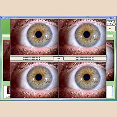 Iriscópio USB IRISCOPO USB de alta resolução, Câmera de iridologia de diagnóstico Eye 5 milhões de pixels HD 30x Iris Lens e software