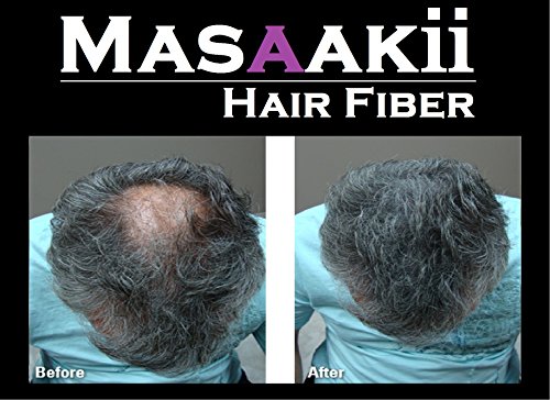 Masaakii Fibra capilar 0,87oz/25g - Tratamento rápido para perda de cabelo Canadá