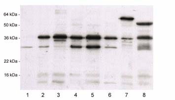 BML -SA480-0025 - Tamanho: 25 microlitros - anticorpo policlonal de coelho anti -estratificação - cada