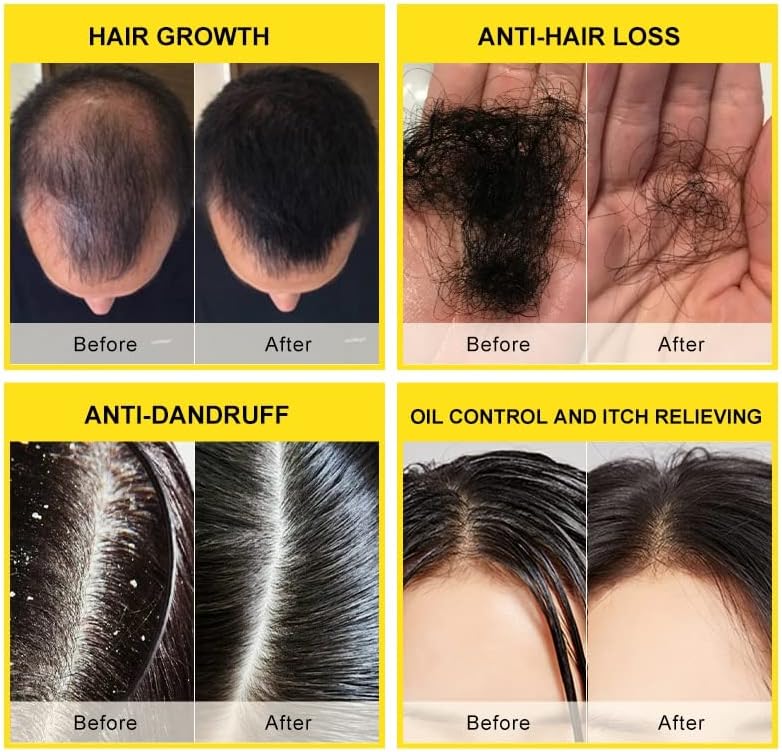 2023 para o óleo de crescimento de crescimento de cabelo de óleo de alecrim para cuidados com os cabelos que perda de cabelo tratamento