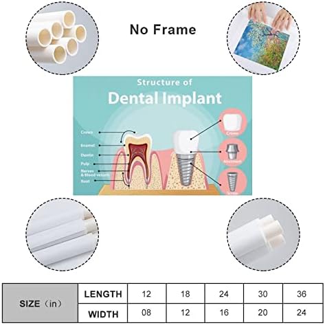 Poster odontológico do Implante Dental Bludug Dental Poster Dental Canvas Pintura Poster de Arte da Parede para o quarto