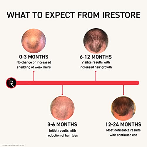 IRESTORE SISTEMA DE CRESCIMENTO DE CABELO A LASER IRESTORE - Tratamentos de perda de cabelo Limpa de FDA para Men e Mulheres