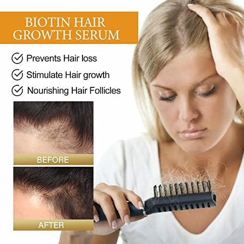 Cabelos densos hidratantes anti -queda de cabelo fixo reparando cabelos de cabelo condicionador de cabelo 60 ml blusas