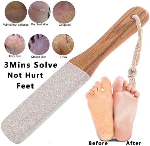 Removedor de calo Kinepi Removedor de pé Cuidado com o pé do pé do pé e ferramentas de pedicure de raspados do esfoliante do pé para